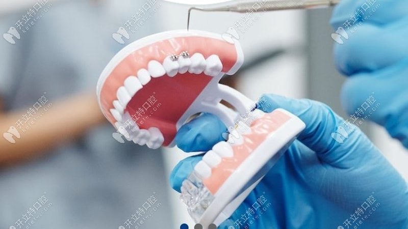 补牙后做牙冠，医保报销知多少？**