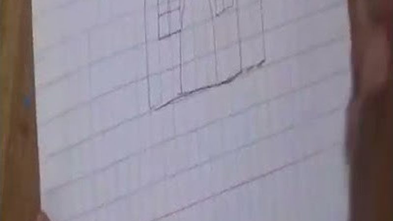 根管治疗，设备选型关键点解析**