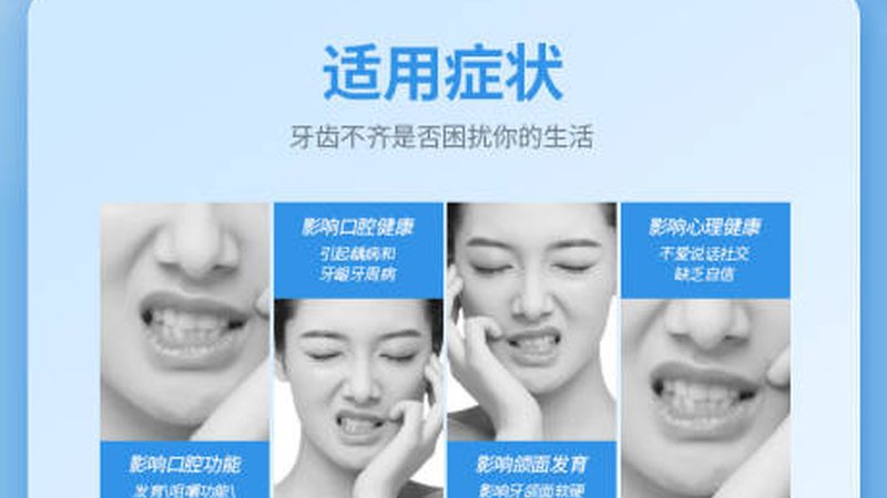 以下是一些在上海地区口碑较好的补牙医院，供您参考：